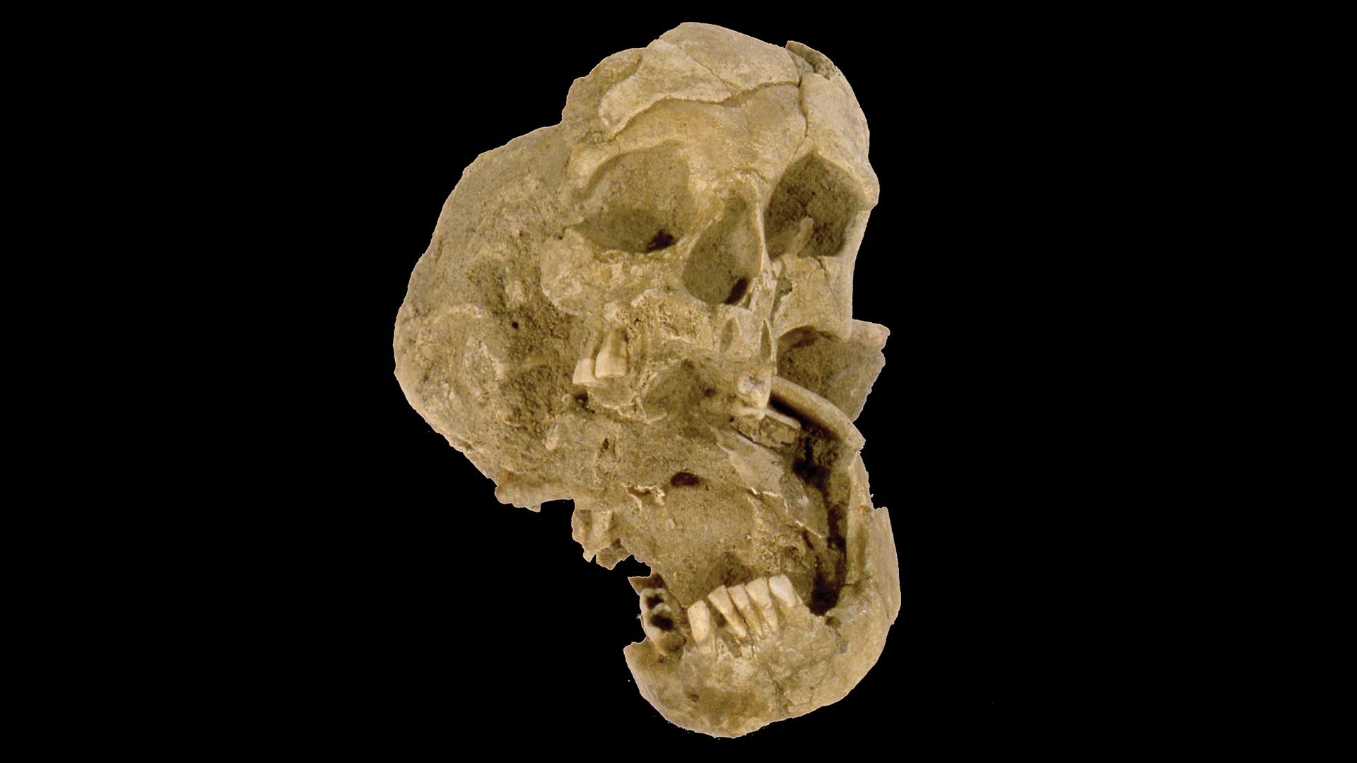 Cranio